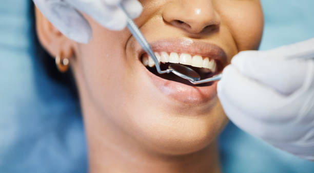 Best Emergency Root Canal Treatment in Clinton, MI